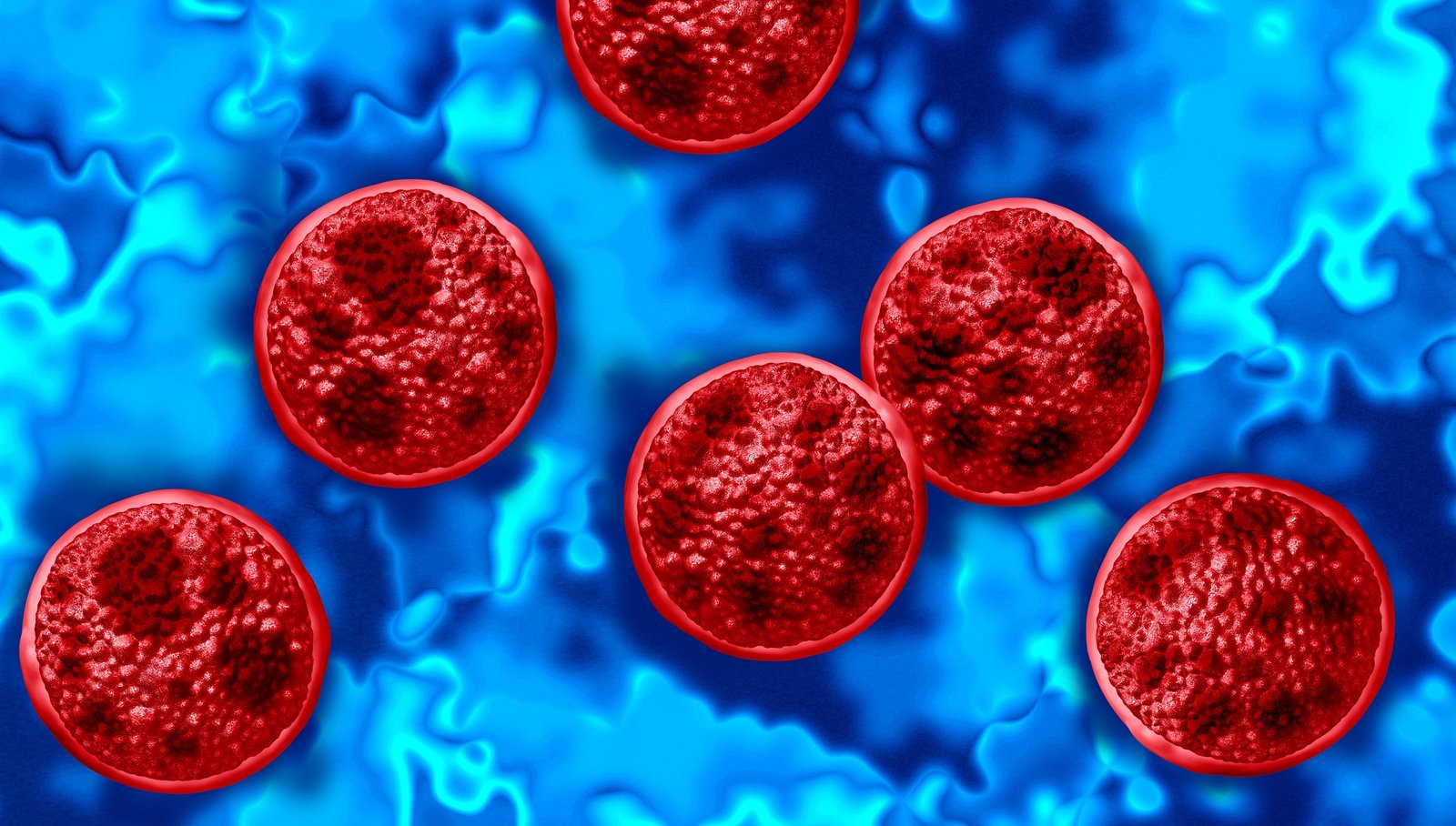 Two people in Michigan have died after becoming ill with cyclosporiasis