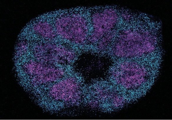 International Team Maps Critical Protein Interactions Underlying Severe Autism Spectrum Disorders