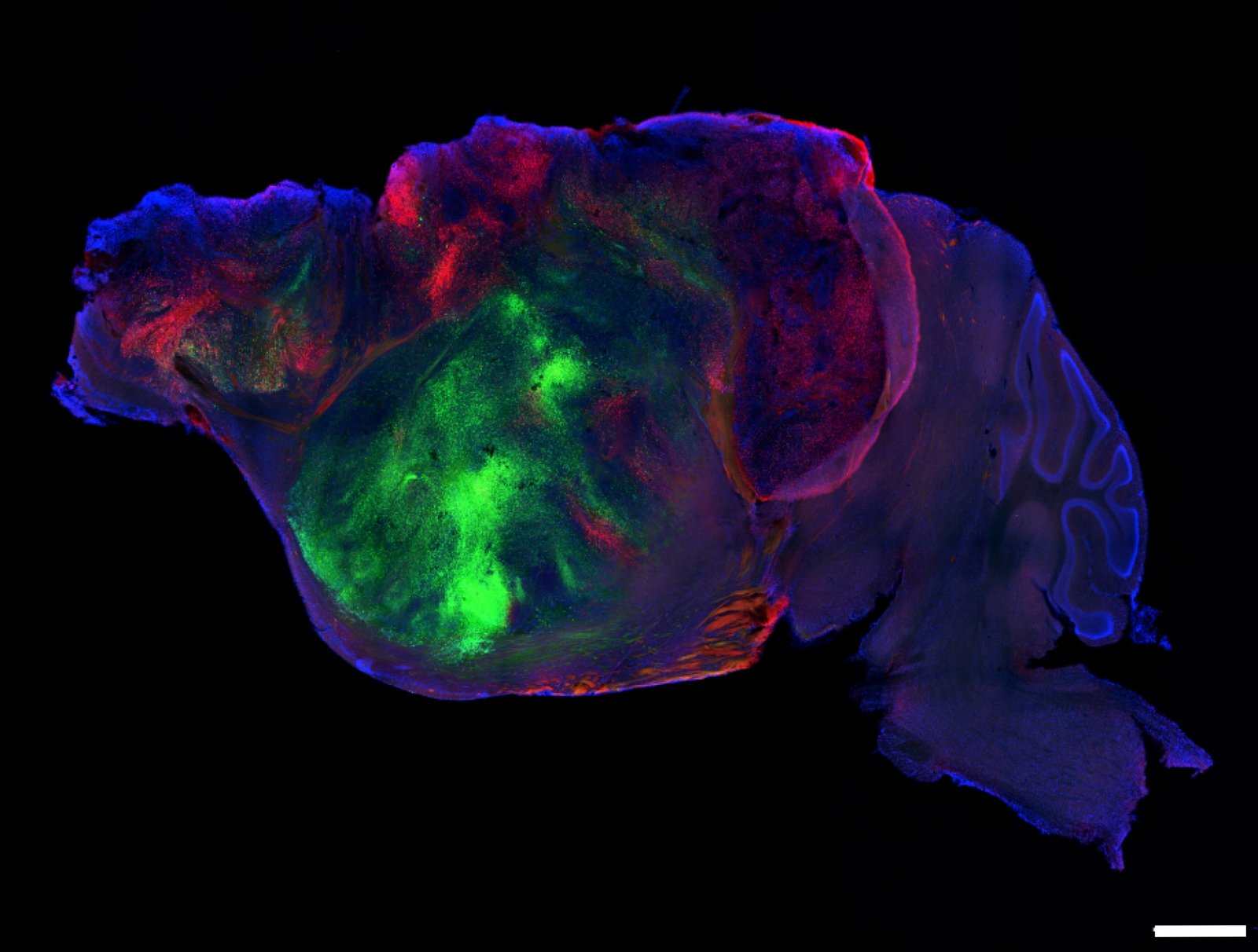 Mice Engineered with Human Brain Cells Provide New Platform for Disease Study; Ethicists Question Future Directions Mice Engineered with Human Brain Cells Provide New Platform for Disease Study; Ethicists Question Future Directions